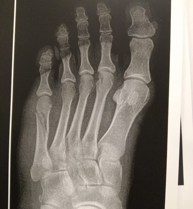 ۱ عکس قبل عمل