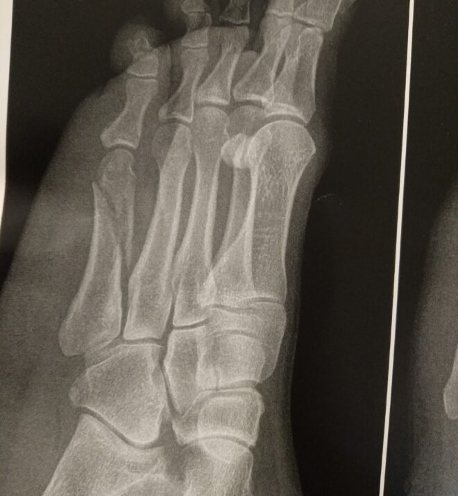 ۲ عکس قبل عمل