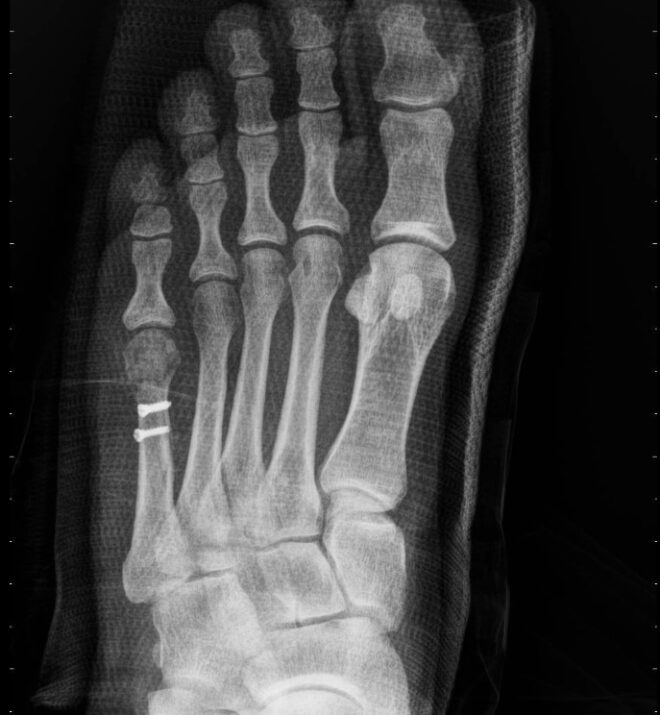 ۳ عکس بعد از عمل