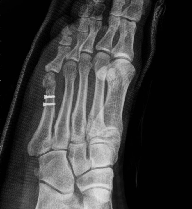 ۴ عکس بعد از عمل